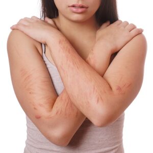 young woman with arms crossed displaying the cuts and scars from self-harm
